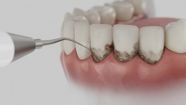Reliable Invisalign Clear Aligners contractor in Mount Olive, MS by Smile Center Dentistry